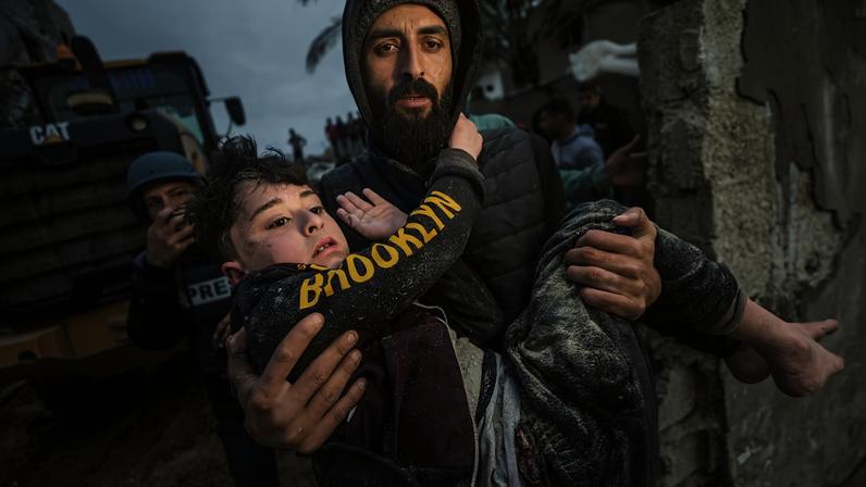 Quase metade dos feridos por balas e estilhaços na cabeça em Gaza são menores