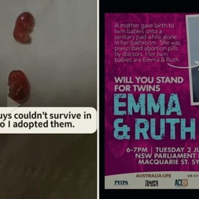 Imagem de bebês gêmeos usados por ativista antiaborto mostra sugar gliders