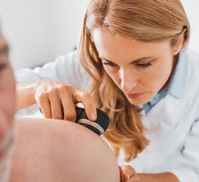 Casos de melanoma no Reino Unido atingem recorde, aponta análise