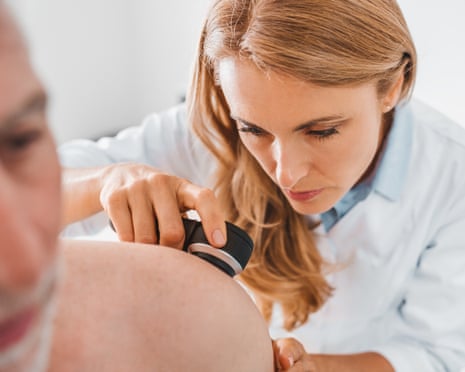 Casos de melanoma no Reino Unido atingem recorde, aponta análise