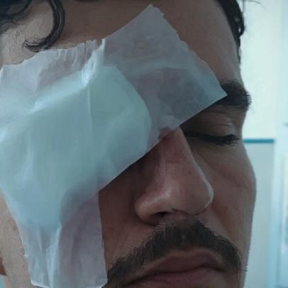 Estudante é atingido por bala de borracha no olho em Flamengo x Vasco
