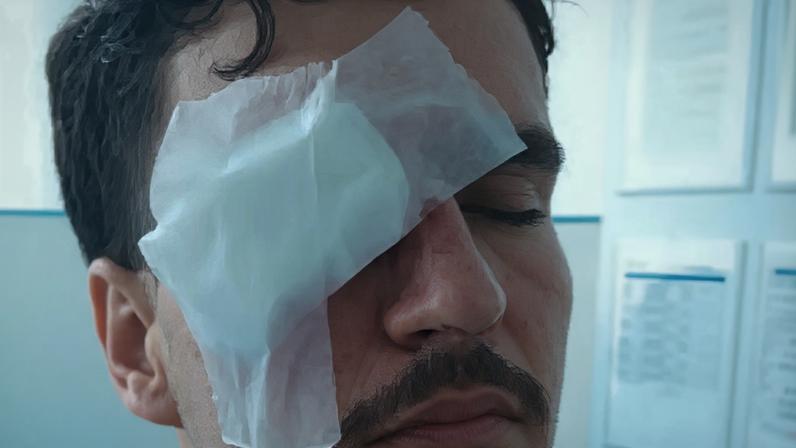 Artur foi atingido por uma bala de borracha no olho direito enquanto saia de Flamengo x Vasco (Foto: Reprodução)
