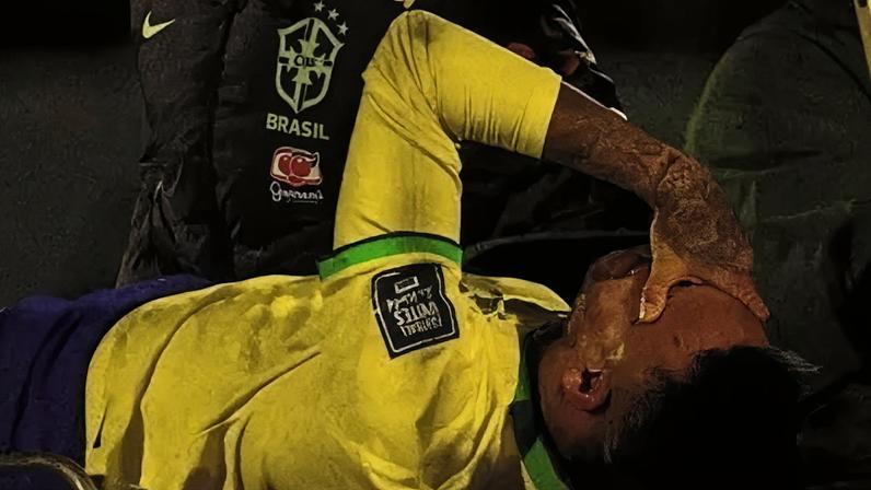 Neymar completa um ano da lesão que o tirou dos gramados durante toda a temporada