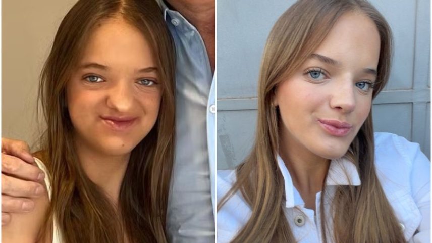 Rafa Justus faz selfie de perto e mostra resultado de rinoplastias