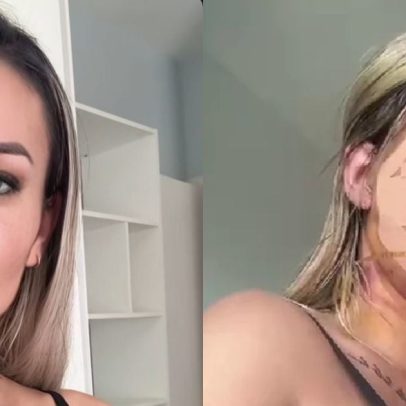 Andressa Urach aparece com a cabeça enfaixada após cirurgia de R$ 100 mil