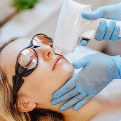 Dermatologia avança com lasers e canetas