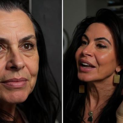 Gretchen comenta alopecia e revela ter pensado em raspar a cabeça