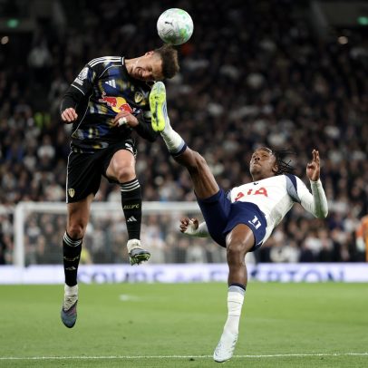 Volante do Leeds mostra ferimento na testa após chute de atacante do Tottenham