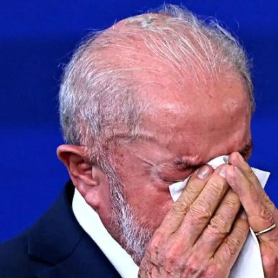 Lula faz radioterapia no couro cabeludo após remoção de câncer de pele