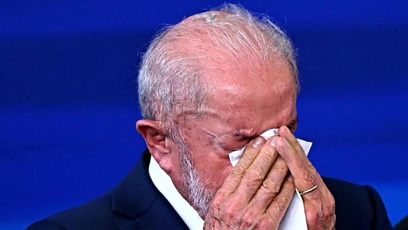 Lula faz radioterapia no couro cabeludo após remoção de câncer de pele