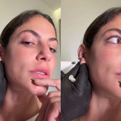 Mari Gonzalez faz procedimento após rasgo na orelha e suspeita de cirurgia