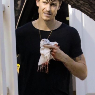 Shawn Mendes sofre lesão na mão com sangue em fotos