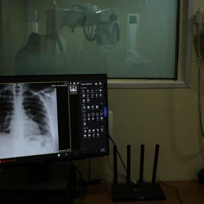 Imposto de Renda não acompanha avanços diagnósticos de doenças