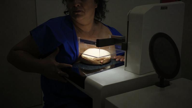 ANS defende cobertura de mamografia digital sem restrição de idade pelos planos