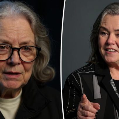 Rosie O’Donnell avalia se fará mais cirurgia plástica após facelift