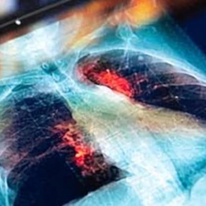 Médicos e NHS podem ser acionados por erros de IA, alerta relatório