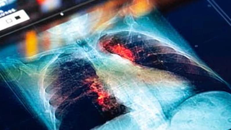 Médicos e NHS podem ser acionados por erros de IA, alerta relatório
