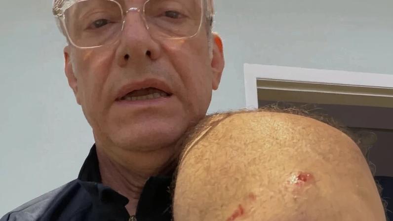 Jornalista José Roberto Burnier é atacado por pitbull e recebe 4 pontos