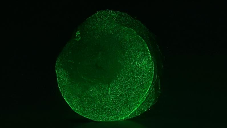 Microscopy image of a tube foot severed from a Psolus fabricii sea cucumber and stained green. Denser green coloring reflects areas of more active cellular processes. Image courtesy of Sara Jobson via American Association for the Advancement of Science (AAAS).