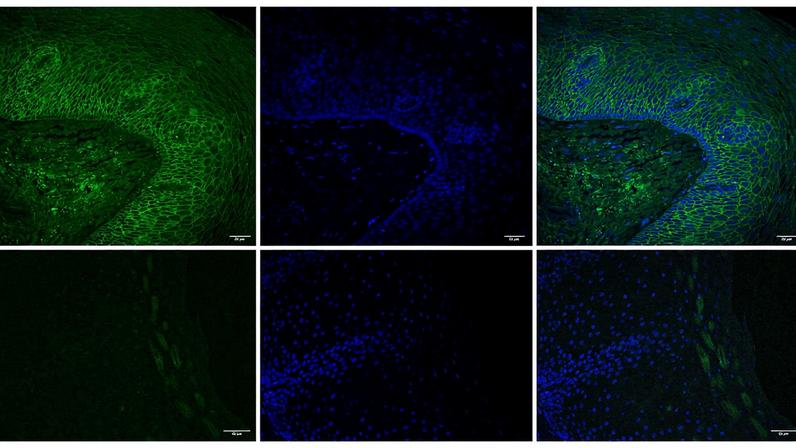 Two rows of immunofluorescence images showing human esophageal tissue