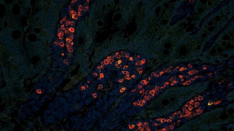 The cells lining the intestine show high levels of IgA antibodies (labeled red), which are associated with mucosal immunity, in rats immunized with the MIT team’s new nanoparticle polio vaccine.