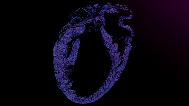 Stylized cross section of a human heart against a black background, with a blue light beam representing ultrasound