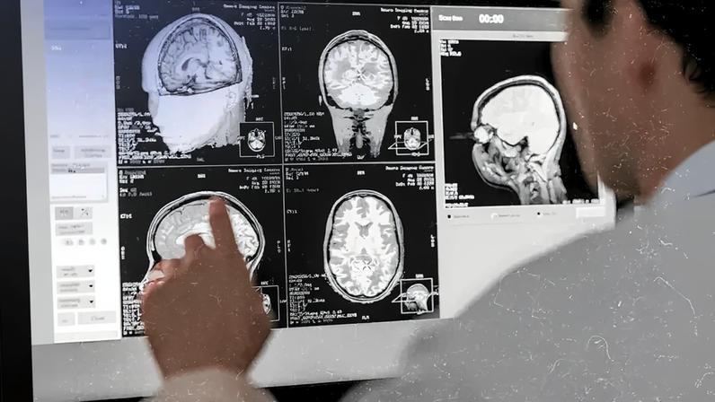 Pessoa de costas, com a mão apontando para uma tela de computador exibindo múltiplas imagens de ressonância magnética do cérebro em tons de cinza, com dados médicos e um cronômetro digital. O lado direito da imagem tem um filtro vermelho.