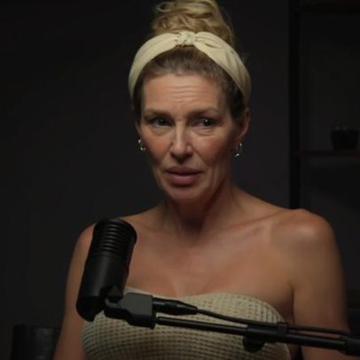 Brandi Glanville revela novo susto de saúde com parasitas faciais