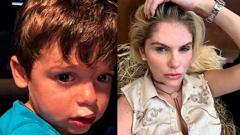 Filho de Bárbara Evans escorrega, machuca o lábio e leva ponto — Foto: Reprodução/Instagram