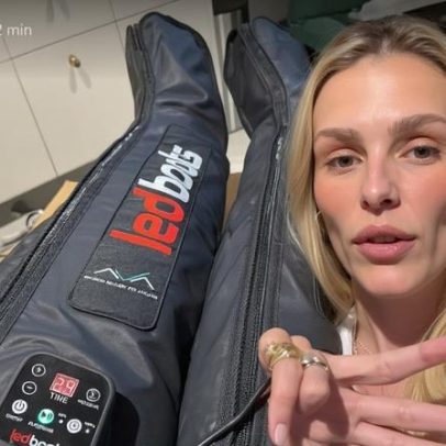 Yasmin Brunet relata crise de lipedema após ingerir glúten
