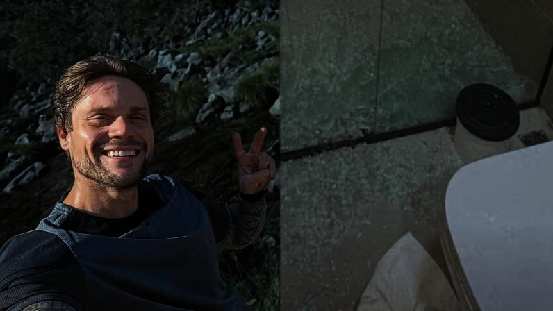 Ex-BBB Breno Simões sofre acidente com box de vidro dias após filho também se acidentar — Foto: Reprodução/Instagram