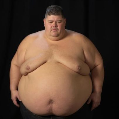 Participante da XJ revela antes e depois de perder 130 kg