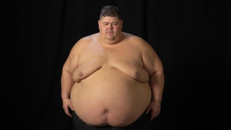 Participante da XJ revela antes e depois de perder 130 kg