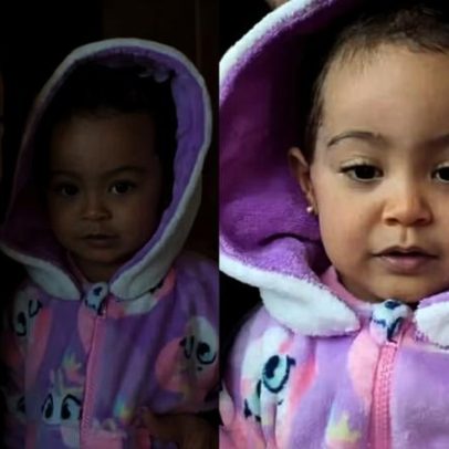 Graciele Lacerda comenta recuperação da filha após cirurgia de nódulo no rosto
