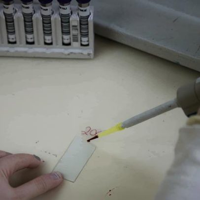 Exames descartam Ebola em imigrante da RDC