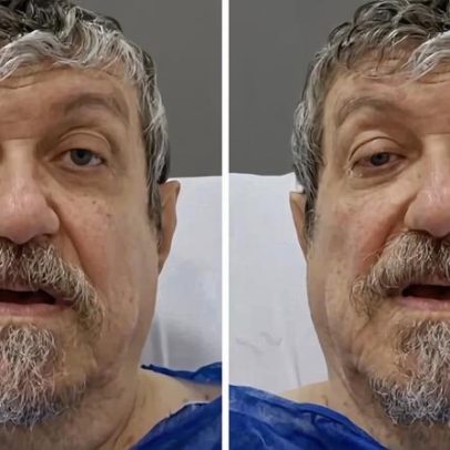 Sayão relata pós-operatório delicado após nova cirurgia