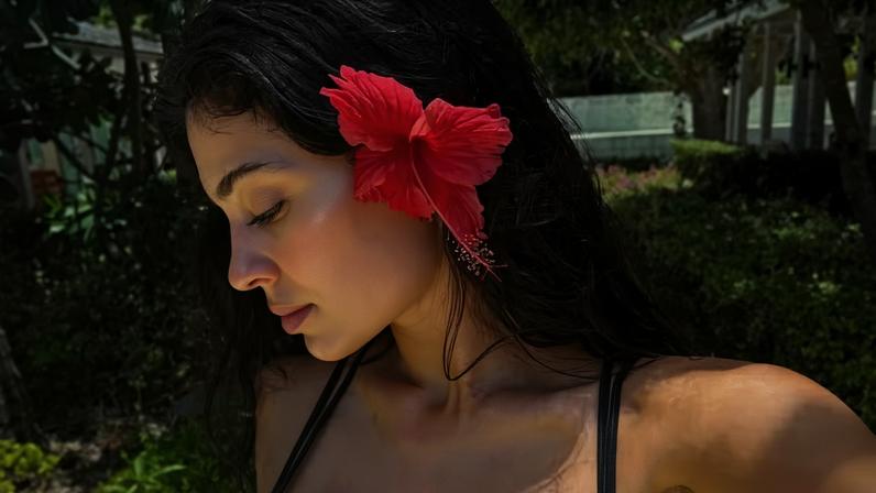 Kylie Jenner aposta em fotos de ângulo estratégico e web reage: 'Não sei lidar com tanta beleza' — Foto: Reprodução/Instagram