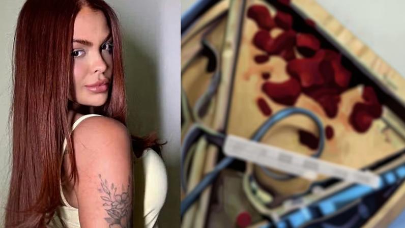 Ex-BBB Paula Freitas faz lipo e descobre problema de procedimento antigo