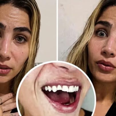 Filha de Leonardo relata quebra de dente após mistura perigosa em noite romântica