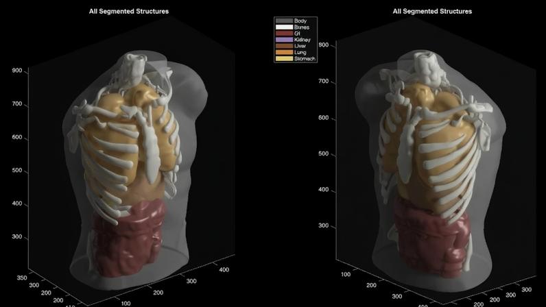 Midjourney vai de imagens de gatos a ultrassom de corpo inteiro