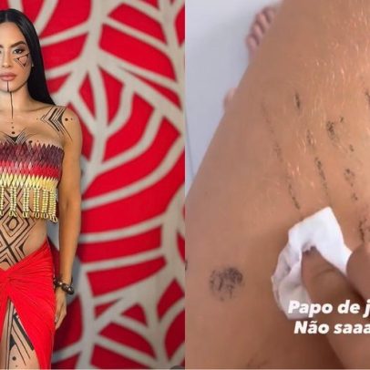 Isabelle Nogueira relata dificuldades para remover grafismo