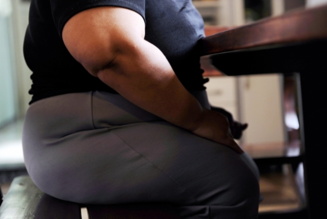 Gordura abdominal e perda de massa muscular afetam saúde após os 50 anos Obesidade e sarcopenia: condições que conspiram para doenças crônicas e morte precoce (Foto: Reprodução)