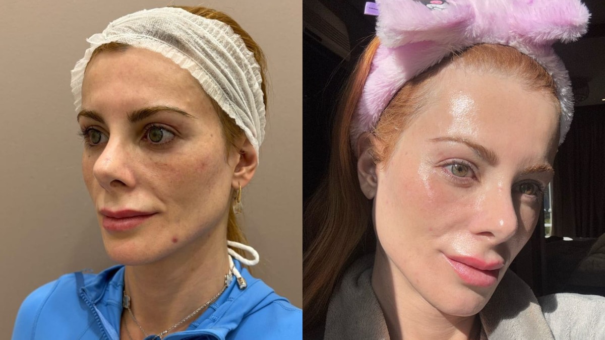 Deborah Albuquerque revela como manter a pele jovem com rotina de beleza coreana Deborah Albuquerque revelou rotina de beleza inspirada em protocolos coreanos (Foto: Divulgação)